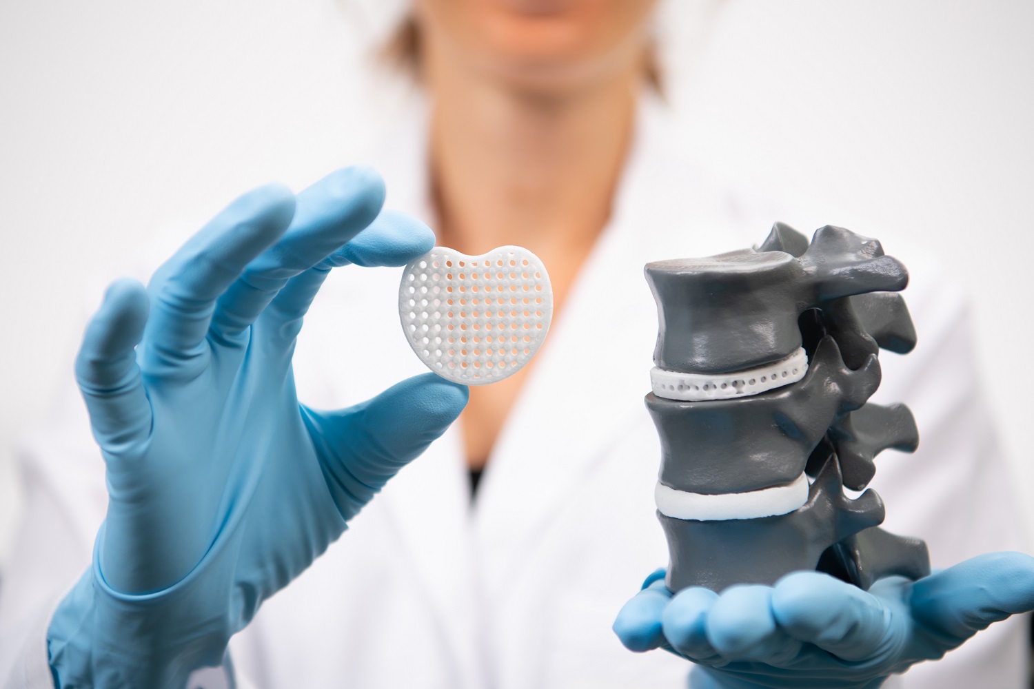 赢创推出可定制RESOMER®PrintPowder，用于植入医疗器械3D打印个性化